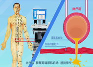 人和医院 尿潴留、尿失禁动画